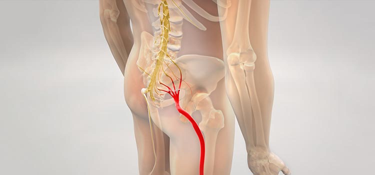 Como identificar se sua dor na perna é causada por um problema na coluna