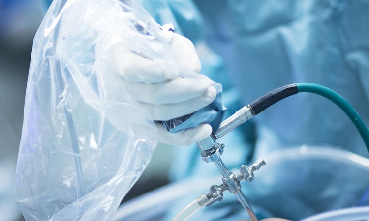 o papel da artroscopia no diagnostico e tratamento das patologias do ombro