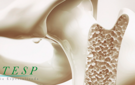 Perda de massa óssea: Como a terapia regenerativa pode ajudar?