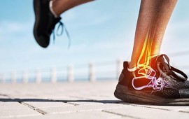 Lesões do Pé e Tornozelo em Corredores: Prevenção e Tratamento