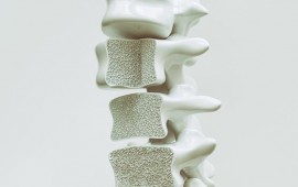 O que é osteopenia?