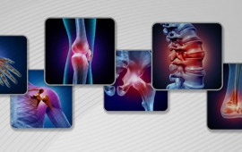 Qual a diferença entre artrite e artrose?