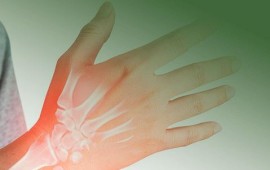 Artrite e Artrose: Entenda a diferença