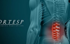 Quem tem hérnia de disco pode praticar exercício físico?